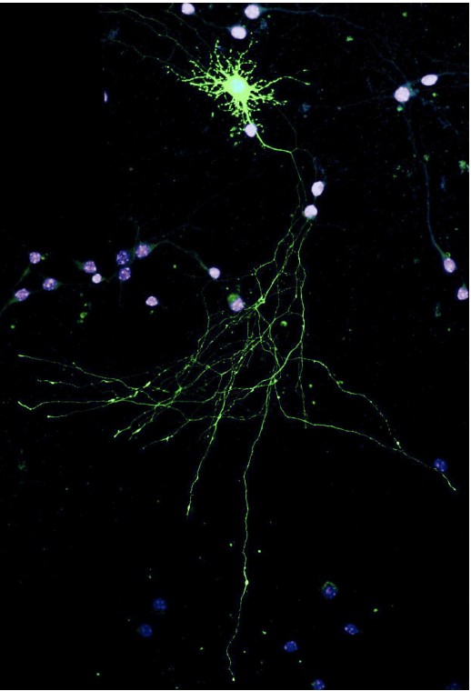 Image of a neuron