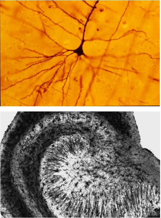 Image of a stained neuron and the brain of a neuron