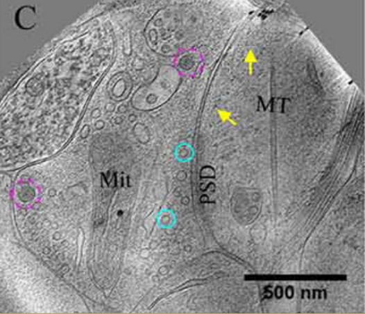 Image of small vesicles and large vesicles