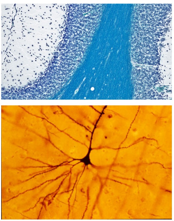 Magnified neuron and a golgi stain