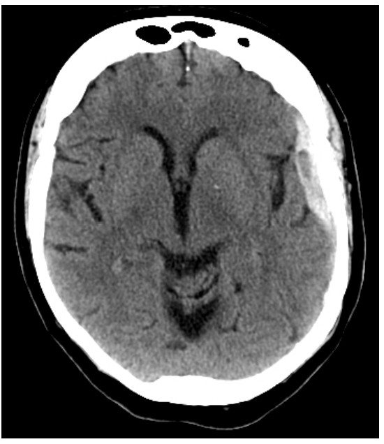 CT scan image