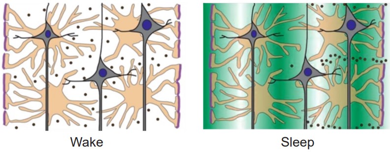 Visualization of CSF washing out amyloid-beta proteins from the interstitial space when we sleep